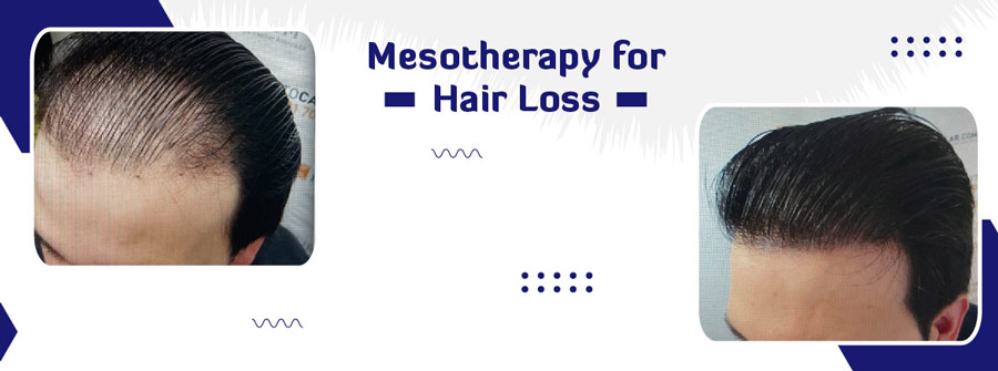 Hair Treatment Doctors in Raipur  View Cost Book Appointment Consult  Online