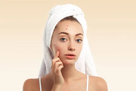 Advanced Skin Treatment at Viva La Skin Clinic